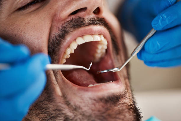 Best Broken or Cracked Tooth Emergency Dentist in Labarque Creek, MO