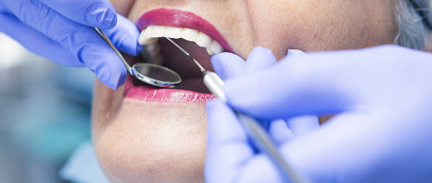 Best Emergency Dentist for Knocked-Out Tooth in Labarque Creek, MO